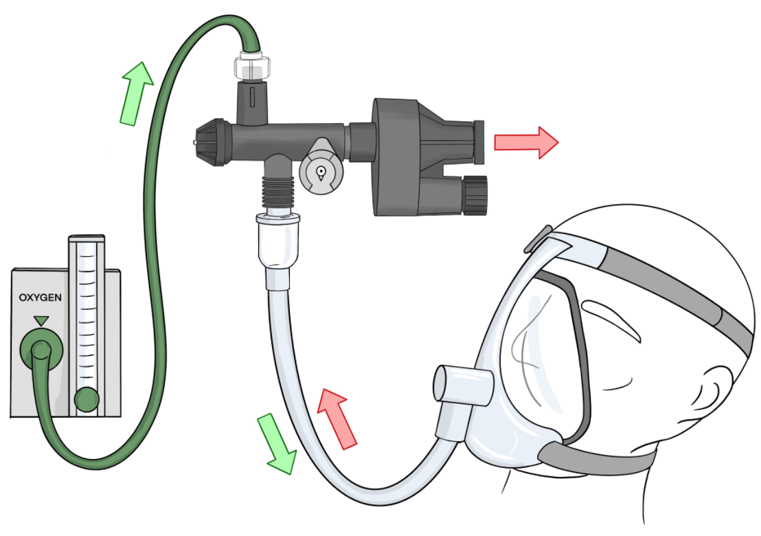 Illustration of Illinois RapidVent on model and connected to wall